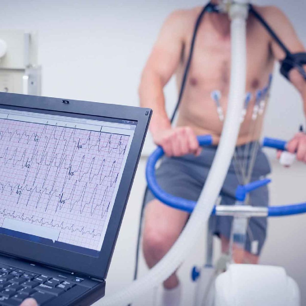 Figura 3. Prueba de esfuerzo.