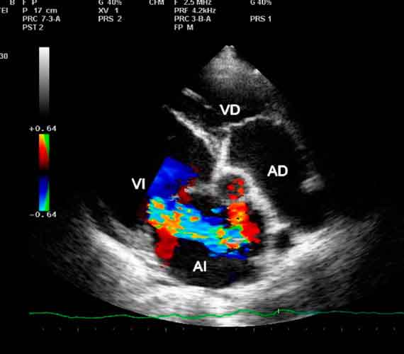 Figura 11. Ecocardiografía.
