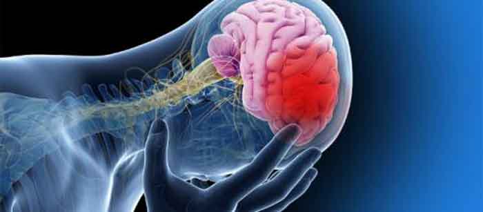 Figura 5. Dolor de cabeza intenso.