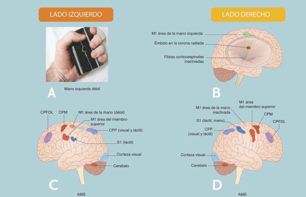 Figura 8. Cada región o área del cerebro, tiene una función específica y de su localización dependerá el tipo de lesión.