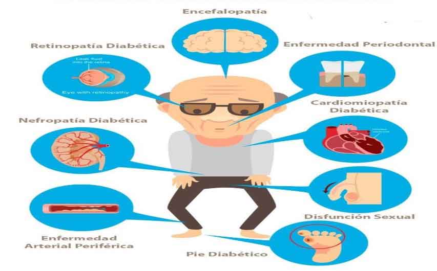 Figura 6. Complicaciones de la diabetes.