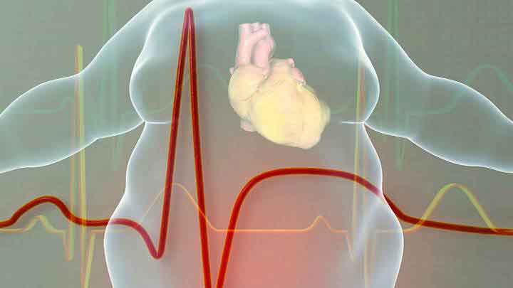 Figura 1. La obesidad predispone a múltiples enfermedades, entre ellas las de corazón.