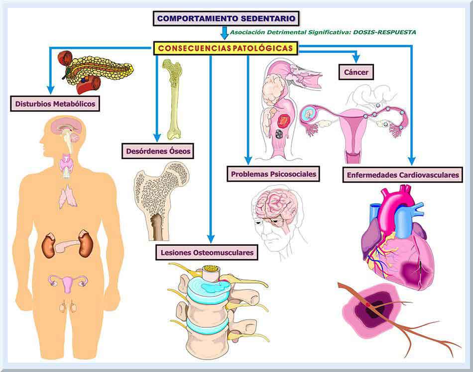 Figura 4. Consecuencias del comportamiento sedentario para nuestra salud.